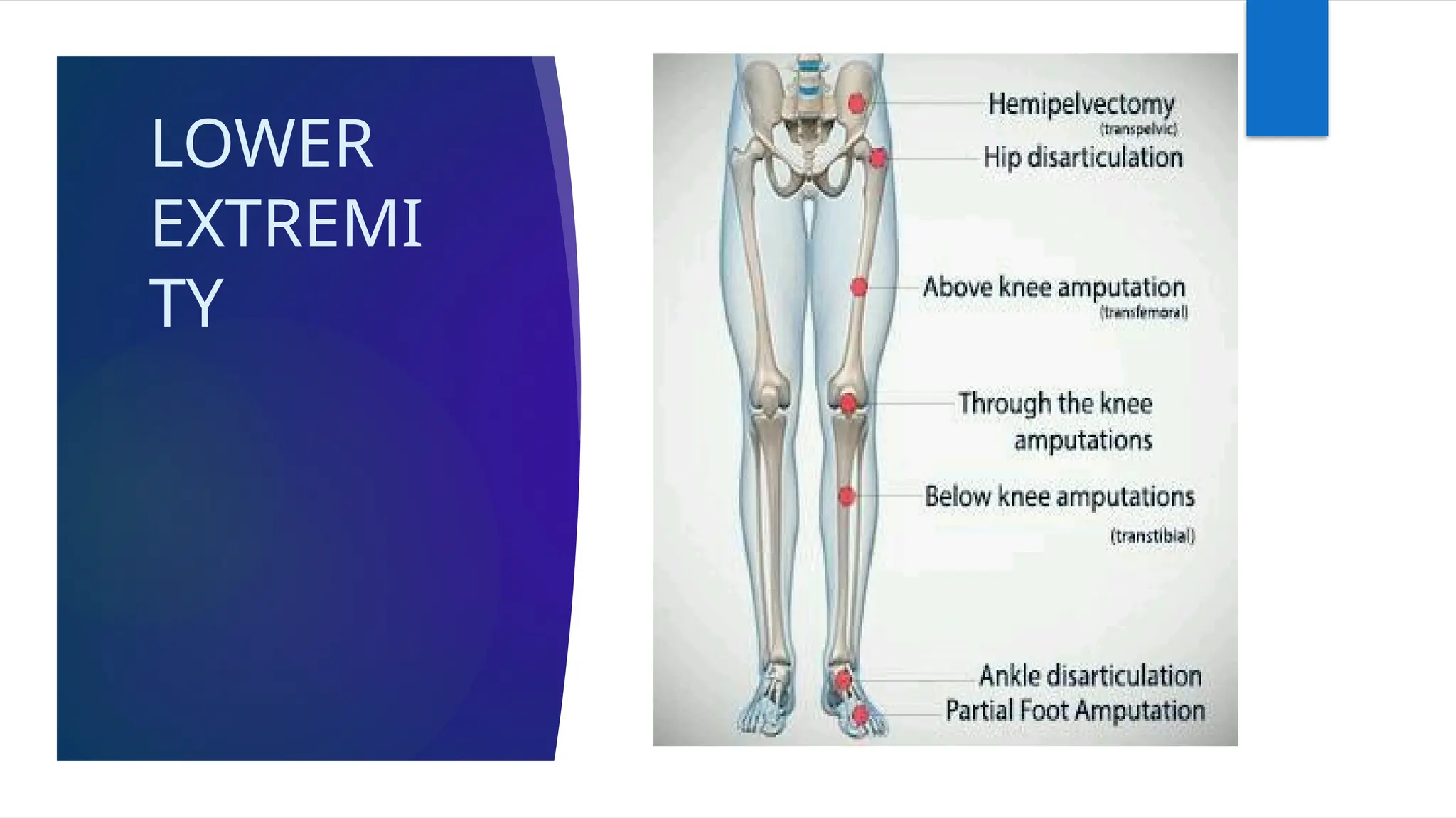 LOWER
EXTREMI
TY
 
