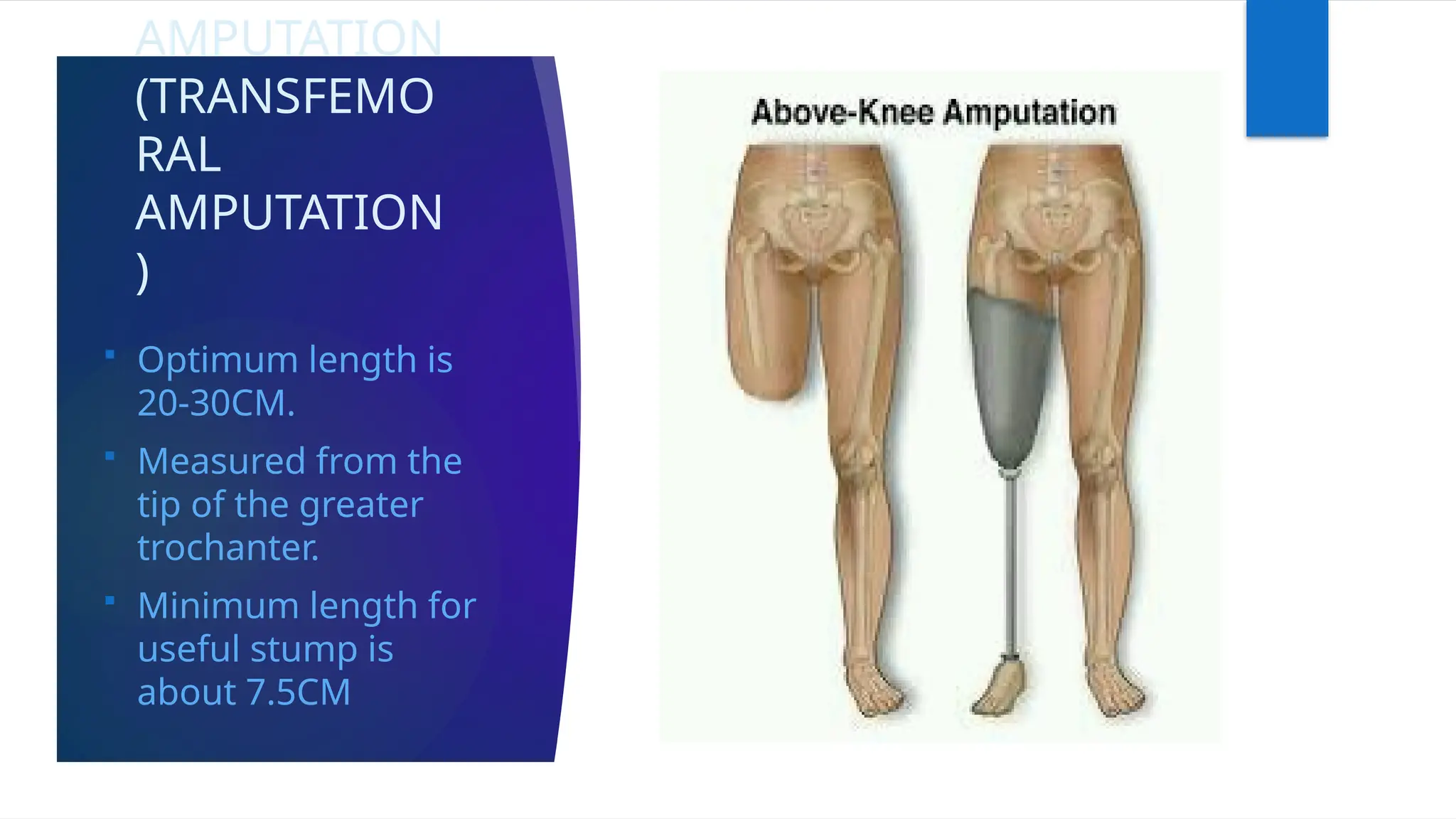 AMPUTATION
(TRANSFEMO
RAL
AMPUTATION
)
 Optimum length is
20-30CM.
 Measured from the
tip of the greater
trochanter.
 Minimum length for
useful stump is
about 7.5CM
 