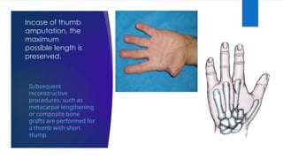 Incase of thumb
amputation, the
maximum
possible length is
preserved.
Subsequent
reconstructive
procedures, such as
metacarpal lengthening
or composite bone
grafts are performed for
a thumb with short
stump.
 