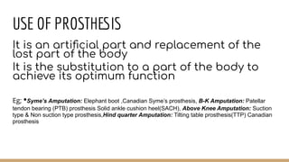 USE OF PROSTHESIS
It is an artiﬁcial part and replacement of the
lost part of the body
It is the substitution to a part of the body to
achieve its optimum function
Eg; •Syme’s Amputation: Elephant boot ,Canadian Syme’s prosthesis, B-K Amputation: Patellar
tendon bearing (PTB) prosthesis Solid ankle cushion heel(SACH), Above Knee Amputation: Suction
type & Non suction type prosthesis,Hind quarter Amputation: Tilting table prosthesis(TTP) Canadian
prosthesis
 