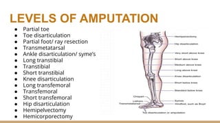 LEVELS OF AMPUTATION
● Partial toe
● Toe disarticulation
● Partial foot/ ray resection
● Transmetatarsal
● Ankle disarticulation/ syme’s
● Long transtibial
● Transtibial
● Short transtibial
● Knee disarticulation
● Long transfemoral
● Transfemoral
● Short transfemoral
● Hip disarticulation
● Hemipelvectomy
● Hemicorporectomy
 