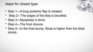 Tibia Step Type AMPUTATION.pptxvivivsovsosvosgosgosgowgowg | PPTX