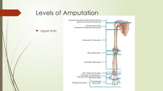 Amputation of the lower limb orthopedics.pptx