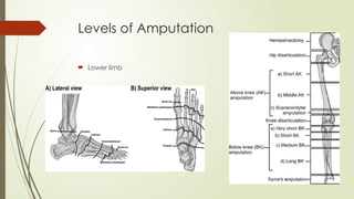 Amputation of the lower limb orthopedics.pptx