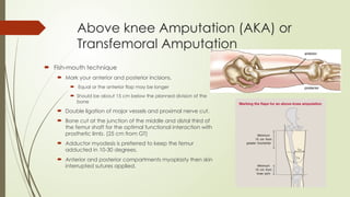 Amputation of the lower limb orthopedics.pptx