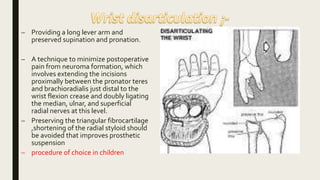 Amputation dr. harsh | PPT