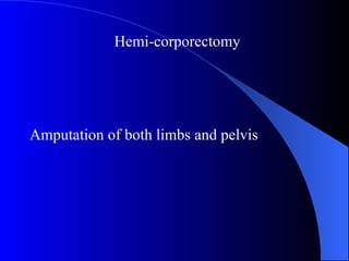 Amputation of both limbs and pelvis
Hemi-corporectomy
 