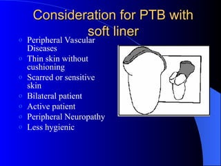 Consideration for PTB with
Consideration for PTB with
soft liner
soft liner
o Peripheral Vascular
Diseases
o Thin skin without
cushioning
o Scarred or sensitive
skin
o Bilateral patient
o Active patient
o Peripheral Neuropathy
o Less hygienic
 