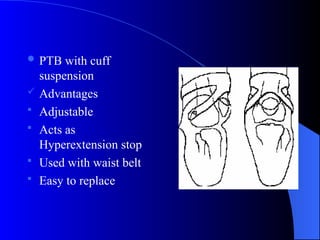  PTB with cuff
suspension
 Advantages
 Adjustable
 Acts as
Hyperextension stop
 Used with waist belt
 Easy to replace
 