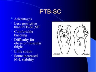PTB-SC
 Advantages
 Less restrictive
than PTB-SC,SP
 Comfortable
kneeling
 Difficulty for
obese or muscular
thighs
 Little straps
 Some increased
M-L stability
 