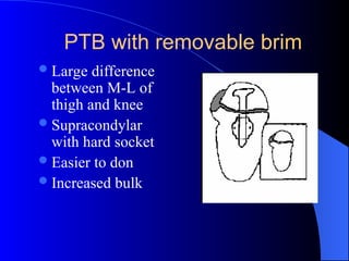 PTB with removable brim
Large difference
between M-L of
thigh and knee
Supracondylar
with hard socket
Easier to don
Increased bulk
 