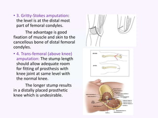 • 3. Gritty-Stokes amputation:
the level is at the distal most
part of femoral condyles.
The advantage is good
fixation of muscle and skin to the
cancellous bone of distal femoral
condyles.
• 4. Trans-femoral (above knee)
amputation: The stump length
should allow adequate room
for fitting of prosthesis with
knee joint at same level with
the normal knee.
The longer stump results
in a distally placed prosthetic
knee which is undesirable.
 