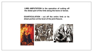 Comprehensive Overview of Amputations and Exarticulation Procedures | PPTX