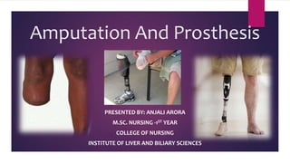 Amputation and prosthesis | PPTX