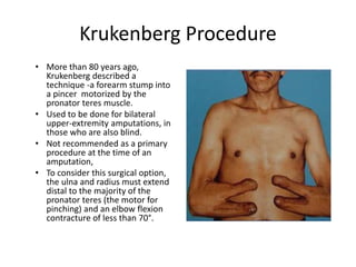 Krukenberg Procedure
• More than 80 years ago,
Krukenberg described a
technique -a forearm stump into
a pincer motorized by the
pronator teres muscle.
• Used to be done for bilateral
upper-extremity amputations, in
those who are also blind.
• Not recommended as a primary
procedure at the time of an
amputation,
• To consider this surgical option,
the ulna and radius must extend
distal to the majority of the
pronator teres (the motor for
pinching) and an elbow flexion
contracture of less than 70°.
 