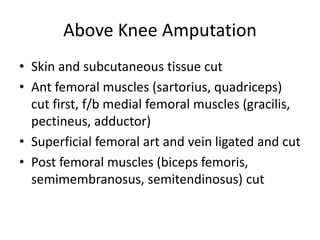 Above Knee Amputation
• Skin and subcutaneous tissue cut
• Ant femoral muscles (sartorius, quadriceps)
cut first, f/b medial femoral muscles (gracilis,
pectineus, adductor)
• Superficial femoral art and vein ligated and cut
• Post femoral muscles (biceps femoris,
semimembranosus, semitendinosus) cut
 