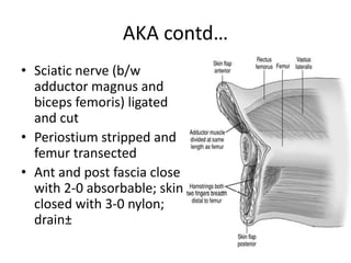 AKA contd…
• Sciatic nerve (b/w
adductor magnus and
biceps femoris) ligated
and cut
• Periostium stripped and
femur transected
• Ant and post fascia close
with 2-0 absorbable; skin
closed with 3-0 nylon;
drain±
 