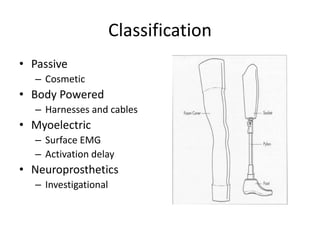 Classification
• Passive
– Cosmetic
• Body Powered
– Harnesses and cables
• Myoelectric
– Surface EMG
– Activation delay
• Neuroprosthetics
– Investigational
 