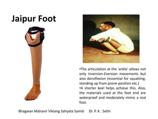 Jaipur Foot
Bhagwan Mahavir Viklang Sahyata Samiti Dr. P. K . Sethi
•The articulation at the 'ankle' allows not
only Inversion-Eversion movements but
also dorsiflexion (essential for squatting,
standing up from prone position etc.)
•A shorter keel helps achieve this. Also,
the materials used at the foot end are
waterproof and moderately mimic a real
foot.
 