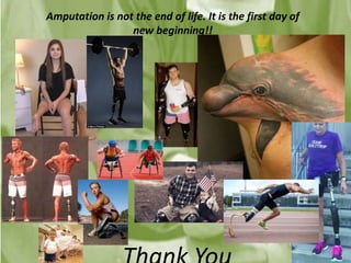 Amputation is not the end of life. It is the first day of
new beginning!!
 