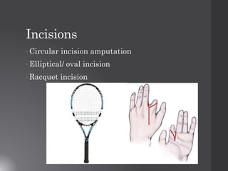 Oval Incision Amputationautosaved | PDF