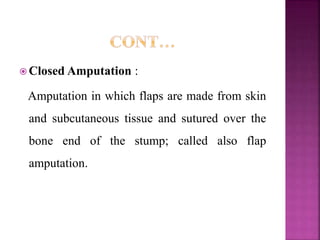  Closed Amputation :
Amputation in which flaps are made from skin
and subcutaneous tissue and sutured over the
bone end of the stump; called also flap
amputation.
 