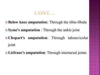  Below knee amputation: Through the tibia-fibula
 Syme's amputation : Through the ankle joint
 Chopart's amputation: Through talonavicular
joint
 Lisfranc's amputation: Through intertarsal joints
 