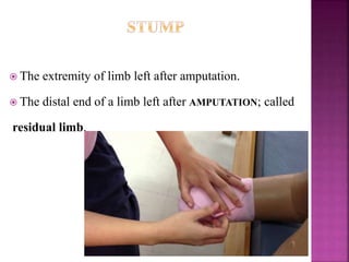  The extremity of limb left after amputation.
 The distal end of a limb left after AMPUTATION; called
residual limb.
 
