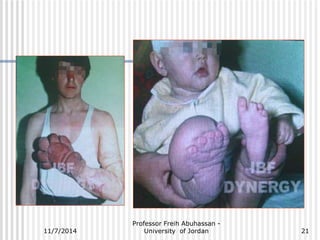 Professor Freih Abuhassan - 
11/7/2014 University of Jordan 
21 
 