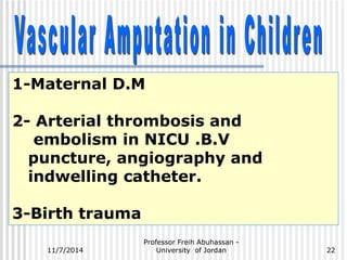 1-Maternal D.M 
2- Arterial thrombosis and 
embolism in NICU .B.V 
puncture, angiography and 
indwelling catheter. 
3-Birth trauma 
Professor Freih Abuhassan - 
11/7/2014 University of Jordan 
22 
 