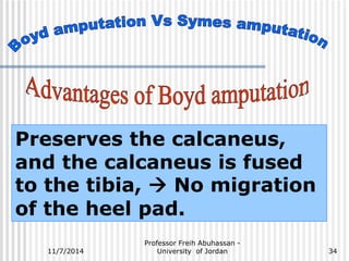 Preserves the calcaneus, 
and the calcaneus is fused 
to the tibia,  No migration 
of the heel pad. 
Professor Freih Abuhassan - 
11/7/2014 University of Jordan 
34 
 