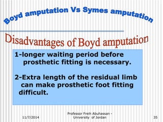1-longer waiting period before 
prosthetic fitting is necessary. 
2-Extra length of the residual limb 
can make prosthetic foot fitting 
difficult. 
Professor Freih Abuhassan - 
11/7/2014 University of Jordan 
35 
 
