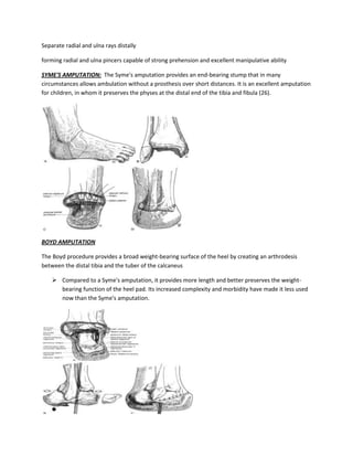 Separate radial and ulna rays distally

forming radial and ulna pincers capable of strong prehension and excellent manipulative ability

SYME'S AMPUTATION: The Syme's amputation provides an end-bearing stump that in many
circumstances allows ambulation without a prosthesis over short distances. It is an excellent amputation
for children, in whom it preserves the physes at the distal end of the tibia and fibula (26).




BOYD AMPUTATION

The Boyd procedure provides a broad weight-bearing surface of the heel by creating an arthrodesis
between the distal tibia and the tuber of the calcaneus

     Compared to a Syme's amputation, it provides more length and better preserves the weight-
      bearing function of the heel pad. Its increased complexity and morbidity have made it less used
      now than the Syme's amputation.
 