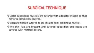 SURGICAL TECHNIQUE
Distal quadriceps muscles are sutured with adductor muscle so that
femur is completely covered.
Biceps femoris is sutured to gracilis and semi tendinous muscle.
The skin flap are brought and sutured apposition and edges are
sutured with mattress suture.
 