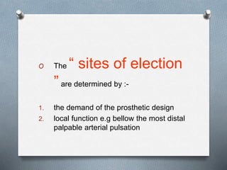 O The “ sites of election
”are determined by :-
1. the demand of the prosthetic design
2. local function e.g bellow the most distal
palpable arterial pulsation
 