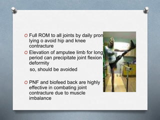 O Full ROM to all joints by daily prone
lying o avoid hip and knee
contracture
O Elevation of amputee limb for long
period can precipitate joint flexion
deformity
so, should be avoided
O PNF and biofeed back are highly
effective in combating joint
contracture due to muscle
imbalance
 