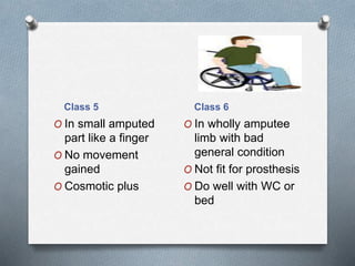 Class 5 Class 6
O In small amputed
part like a finger
O No movement
gained
O Cosmotic plus
O In wholly amputee
limb with bad
general condition
O Not fit for prosthesis
O Do well with WC or
bed
 
