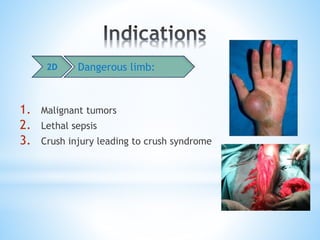 1. Malignant tumors
2. Lethal sepsis
3. Crush injury leading to crush syndrome
2D Dangerous limb:
 