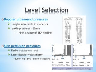 oDoppler ultrasound pressures
 maybe unreliable in diabetics
 ankle pressures >60mm
--->50% chance of BKA healing
oSkin perfusion pressures
 Radio isotope washout
 Laser doppler velocimetry
<20mm Hg – 89% failure of healing
 