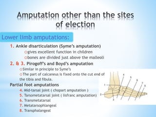 1. Ankle disarticulation (Syme’s amputation)
ogives excellent function in children
obones are divided just above the malleoli
2. & 3. Pirogoff’s and Boyd’s amputation
oSimilar in principle to Syme’s
oThe part of calcaneus is fixed onto the cut end of
the tibia and fibula.
Partial foot amputations
4. Mid-tarsal joint ( chopart amputation )
5. Tarsometatarsal joint ( lisfranc amputation)
6. Transmetatarsal
7. Metatarsophlangeal
8. Transphalangeal
Lower limb amputations:
 