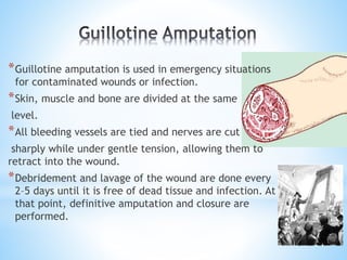 *Guillotine amputation is used in emergency situations
for contaminated wounds or infection.
*Skin, muscle and bone are divided at the same
level.
*All bleeding vessels are tied and nerves are cut
sharply while under gentle tension, allowing them to
retract into the wound.
*Debridement and lavage of the wound are done every
2–5 days until it is free of dead tissue and infection. At
that point, definitive amputation and closure are
performed.
 