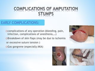 ocomplications of any operation (bleeding, pain,
infection, complications of anesthesia,…)
oBreakdown of skin flaps (may be due to ischemia
or excessive suture tension )
oGas gangrene (especially AKA)
EARLY COMPLICATIONS:
 