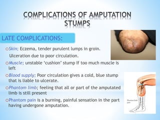 oSkin; Eczema, tender purulent lumps in groin.
Ulceration due to poor circulation.
oMuscle; unstable ‘cushion’ stump If too much muscle is
left
oBlood supply; Poor circulation gives a cold, blue stump
that is liable to ulcerate.
oPhantom limb; feeling that all or part of the amputated
limb is still present
oPhantom pain is a burning, painful sensation in the part
having undergone amputation.
LATE COMPLICATIONS:
 