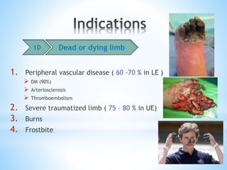 1. Peripheral vascular disease ( 60 -70 % in LE )
 DM (90%)
 Arteriosclerosis
 Thromboembolism
2. Severe traumatized limb ( 75 – 80 % in UE)
3. Burns
4. Frostbite
1D Dead or dying limb
 