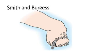 Smith and Burgess
 