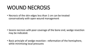 WOUND NECROSIS
• Necrosis of the skin edges less than 1 cm can be treated
conservatively with open wound management
• Severe necrosis with poor coverage of the bone end, wedge resection
may be indicated.
• Basic principle of wedge resection : reformation of the hemisphere,
while minimizing local pressures
 