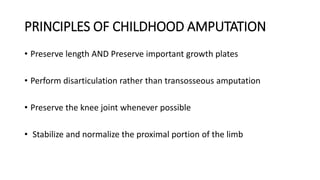 PRINCIPLES OF CHILDHOOD AMPUTATION
• Preserve length AND Preserve important growth plates
• Perform disarticulation rather than transosseous amputation
• Preserve the knee joint whenever possible
• Stabilize and normalize the proximal portion of the limb
 