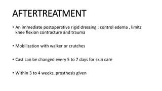 AFTERTREATMENT
• An immediate postoperative rigid dressing : control edema , limits
knee flexion contracture and trauma
• Mobilization with walker or crutches
• Cast can be changed every 5 to 7 days for skin care
• Within 3 to 4 weeks, prosthesis given
 