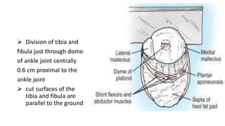  Division of tibia and
fibula just through dome
of ankle joint centrally
0.6 cm proximal to the
ankle joint
 cut surfaces of the
tibia and fibula are
parallel to the ground
 