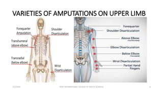 VARIETIES OF AMPUTATIONS ON UPPER LIMB
2/2/2024 ZERA INTERNATIONAL COLLEGE OF HEALTH SCIENCES 8
 